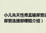 小儿先天性肾盂输尿管连接部梗阻（关于小儿先天性肾盂输尿管连接部梗阻介绍）