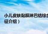 小儿皮肤黏膜淋巴结综合征（关于小儿皮肤黏膜淋巴结综合征介绍）