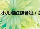 小儿潮红综合征（关于小儿潮红综合征介绍）