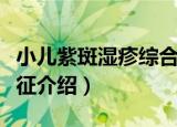小儿紫斑湿疹综合征（关于小儿紫斑湿疹综合征介绍）