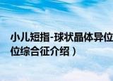 小儿短指-球状晶体异位综合征（关于小儿短指-球状晶体异位综合征介绍）