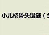 小儿桡骨头错缝（关于小儿桡骨头错缝介绍）