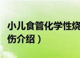 小儿食管化学性烧伤（关于小儿食管化学性烧伤介绍）