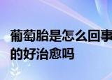 葡萄胎是怎么回事是怎么形成的病状是什么样的好治愈吗