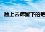 脸上去痣留下的疤痕怎么去掉（脸上去痣）
