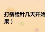 打瘦脸针几天开始有效果（打瘦脸针几天有效果）