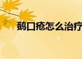 鹅口疮怎么治疗最好（鹅口疮怎么治）