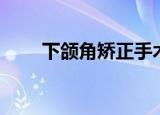 下颌角矫正手术疼吗（下颌角矫正）