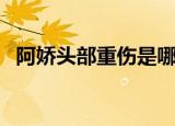 阿娇头部重伤是哪个医生（阿娇头部重伤）
