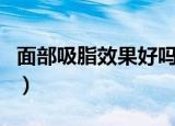 面部吸脂效果好吗怎么样（面部吸脂效果好吗）