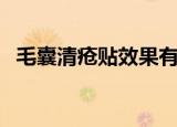 毛囊清疮贴效果有那么好吗（毛囊清疮贴）